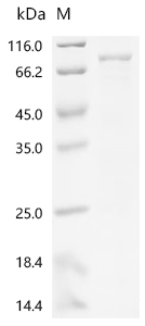 ZAP70 Protein, Human, Recombinant (His)