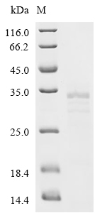 LECT2 Protein, Mouse, Recombinant (His & Myc)