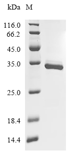 SIRT5 Protein, Mouse, Recombinant (His & Myc)