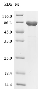 DLAT Protein, Human, Recombinant (E. coli, His)