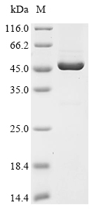 KRT18 Protein, Human, Recombinant (His)