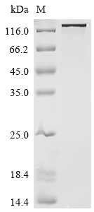 L1CAM Protein, Human, Recombinant (His & Myc)