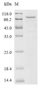 ALOX5 Protein, Human, Recombinant (His)