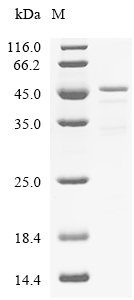 HNRNPA2B1 Protein, Human, Recombinant (His & Myc)