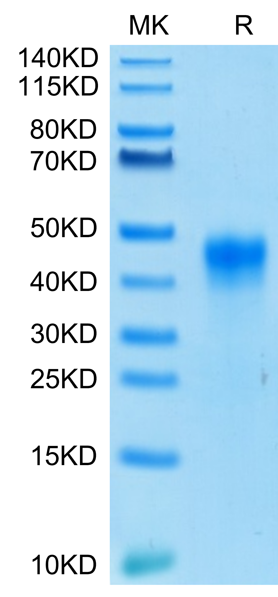 FOLR1 Protein, Human, Recombinant (His & Avi), Biotinylated