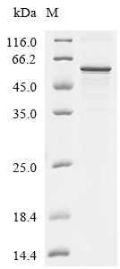 LOXL1 Protein, Human, Recombinant (His)