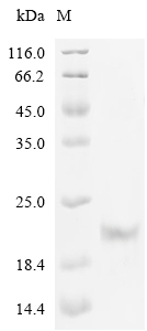 SVEP1 Protein, Human, Recombinant (His)