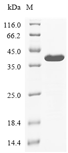 TSST-1 Protein, S. aureus, Recombinant (His & SUMO)