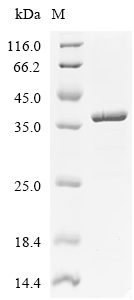 Rift valley fever virus (RVFV) (strain ZH-548 M12) Non-structural protein S (His & Myc)