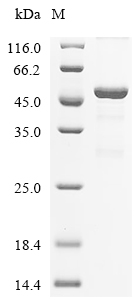 LDHC Protein, Human, Recombinant (His & SUMO)