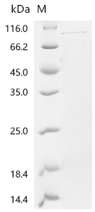 HNRNPL Protein, Human, Recombinant (aa 1-589, His & SUMO)