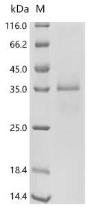 Granzyme K/GZMK Protein, Mouse, Recombinant (His & Myc)