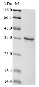 GPRC5A Protein, Human, Recombinant (GST)