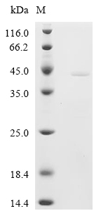 MYL6 Protein, Human, Recombinant (GST)