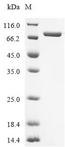 Diphtheria toxin Protein, Corynephage beta, Recombinant (His)