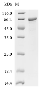 TAS1R1 Protein, Human, Recombinant (His & Myc)