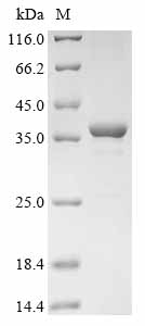 CCND1 Protein, Human, Recombinant (His)