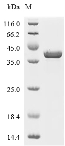 RAB11A Protein, Human, Recombinant (His & SUMO)