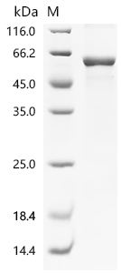 TRIM21 Protein, Human, Recombinant (E. coli, His)