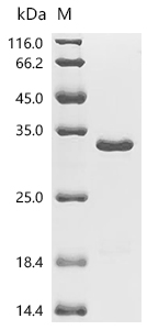 HSD17B13 Protein, Human, Recombinant (His & Myc)