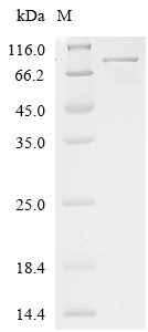 PAK1 Protein, Human, Recombinant (His & SUMO)