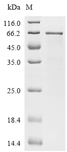 MKNK1 Protein, Human, Recombinant (His)