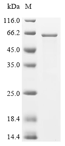 E2F1 Protein, Human, Recombinant (His)