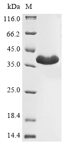 Zinc metalloproteinase Protein, Legionella pneumophila, Recombinant (His)