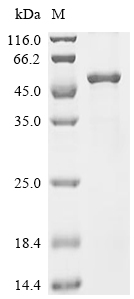TUBB Protein, Human, Recombinant (His)