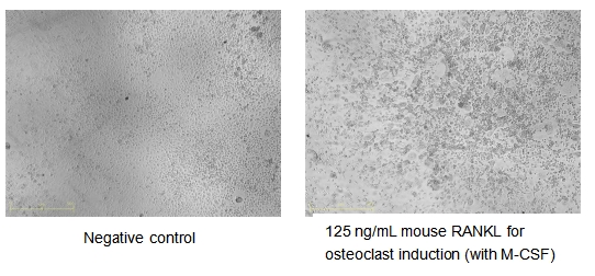 RANKL/TNFSF11/CD254 Protein, Mouse, Recombinant (Flag & His)