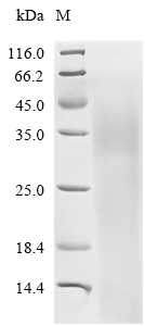 SLC1A3 Protein, Human, Recombinant (His)