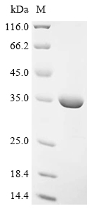 BRCC3 Protein, Mouse, Recombinant (His)