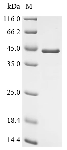 Reticulocalbin-1/RCN1 Protein, Human, Recombinant (His)