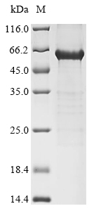 DEK Protein, Human, Recombinant (His & Myc)