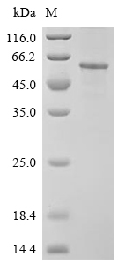 CCNB1 Protein, Human, Recombinant (His)