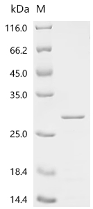 RB1 Protein, Human, Recombinant (His)