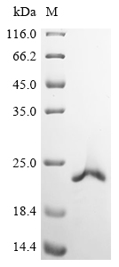 DHX36 Protein, Human, Recombinant (His & Myc)