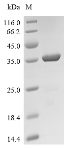 OmcB Protein, Chlamydia trachomatis, Recombinant (His & SUMO)