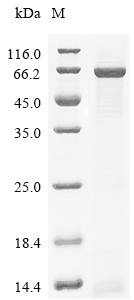 ATP5F1A Protein, Human, Recombinant (His)
