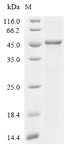 RNF126 Protein, Human, Recombinant (His)