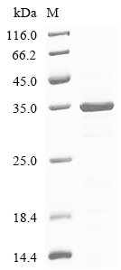TYK2 Protein, Human, Recombinant (His)