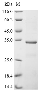 SAP130 Protein, Mouse, Recombinant (His)