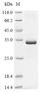 COL4A3 Protein, Mouse, Recombinant (His & Myc)