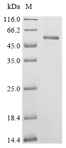 TRIM21 Protein, Mouse, Recombinant (His)