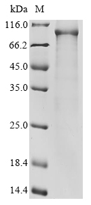 IKBKB Protein, Human, Recombinant (His)