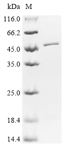 MAGEA3 Protein, Human, Recombinant (His)