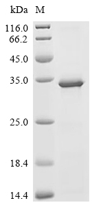 TNFAIP6 Protein, Human, Recombinant (His)