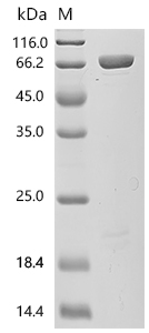 Exopolyphosphatase Protein, E. coli, Recombinant (His & SUMO)