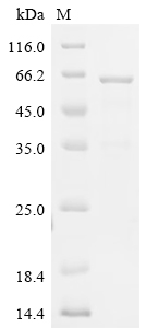 CDC20 Protein, Human, Recombinant (His & Myc)