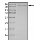 DGKH Protein, Human, Recombinant (His)